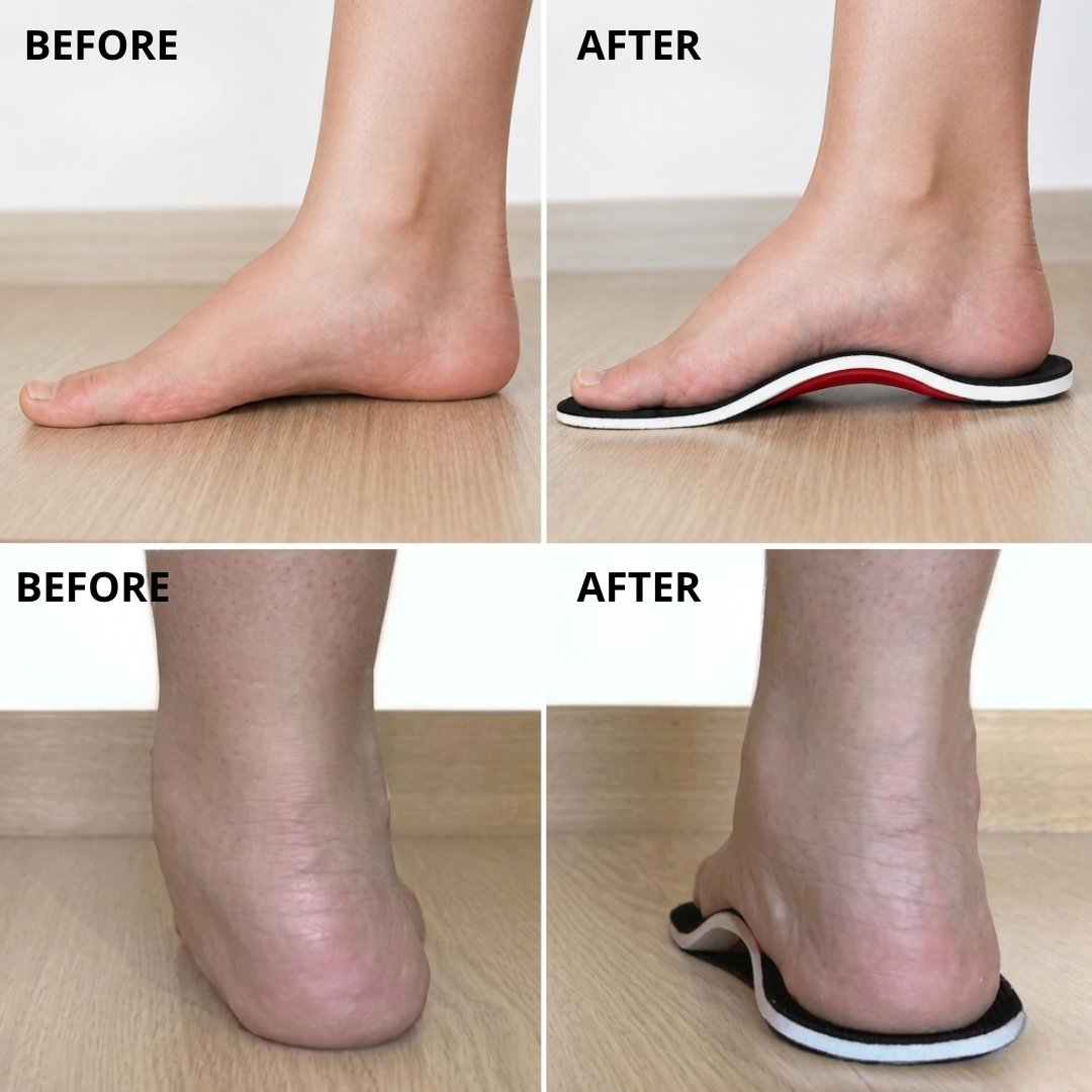TrueStep® Alignment Insoles